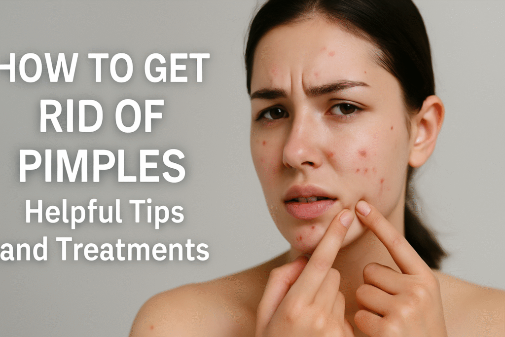How to Get Rid of Pimples